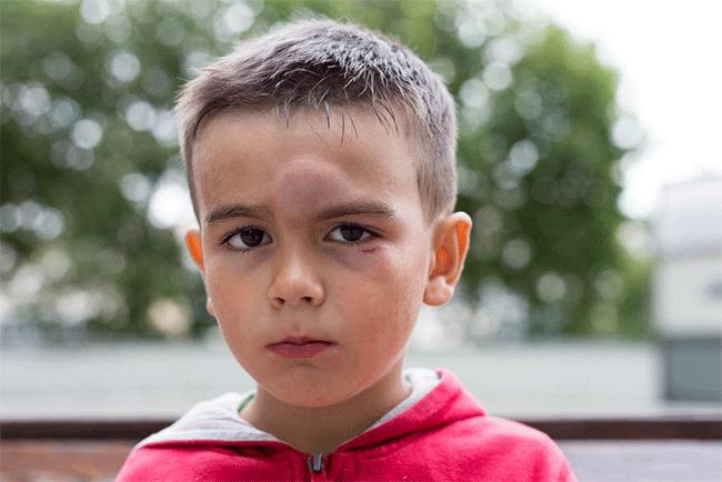 Golpes en la cabeza- iquesten queacute casos son lesiones graves