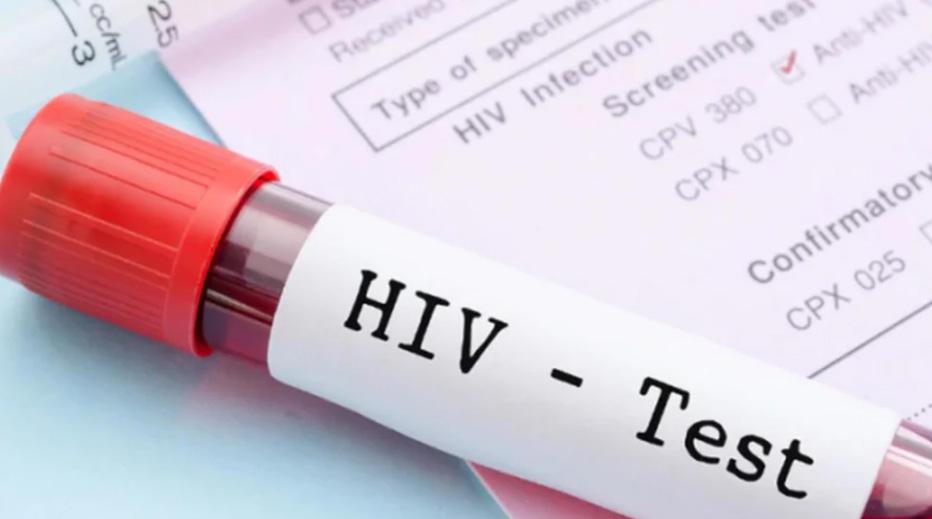 Realizan pruebas de VIH en casi toda la provincia