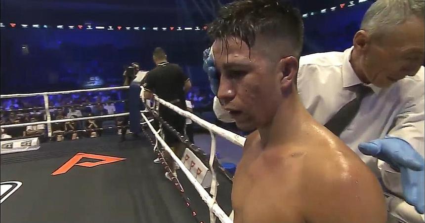 Perouene cayoacute por puntos ante Fader Herrera