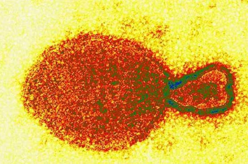 Nuevo virus Langya hallado en China- lo que los cientiacuteficos saben hasta ahora