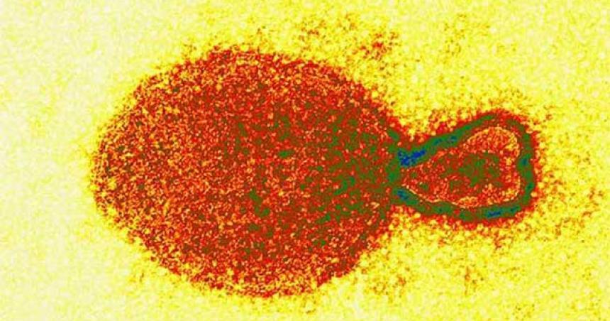 Nuevo virus Langya hallado en China- lo que los cientiacuteficos saben hasta ahora