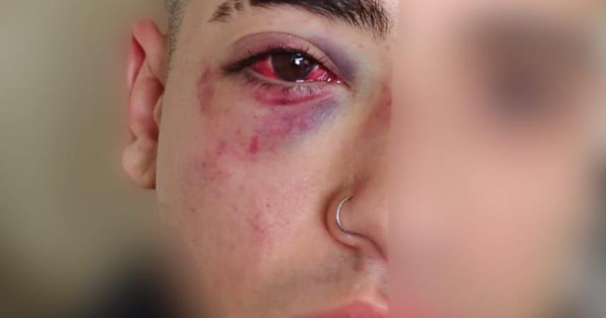 Acusan a patovicas por una golpiza