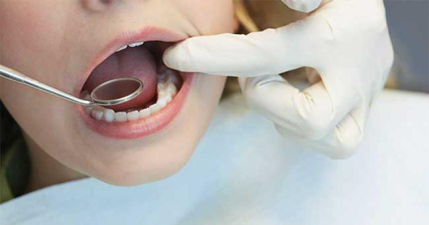 Coacutemo eliminar el sarro y blanquear los dientes de manera natural