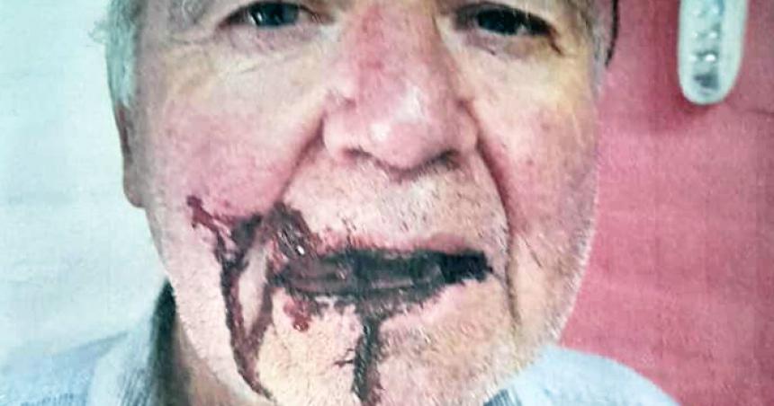 Salvaje golpiza a un jubilado en el barrio Atuel