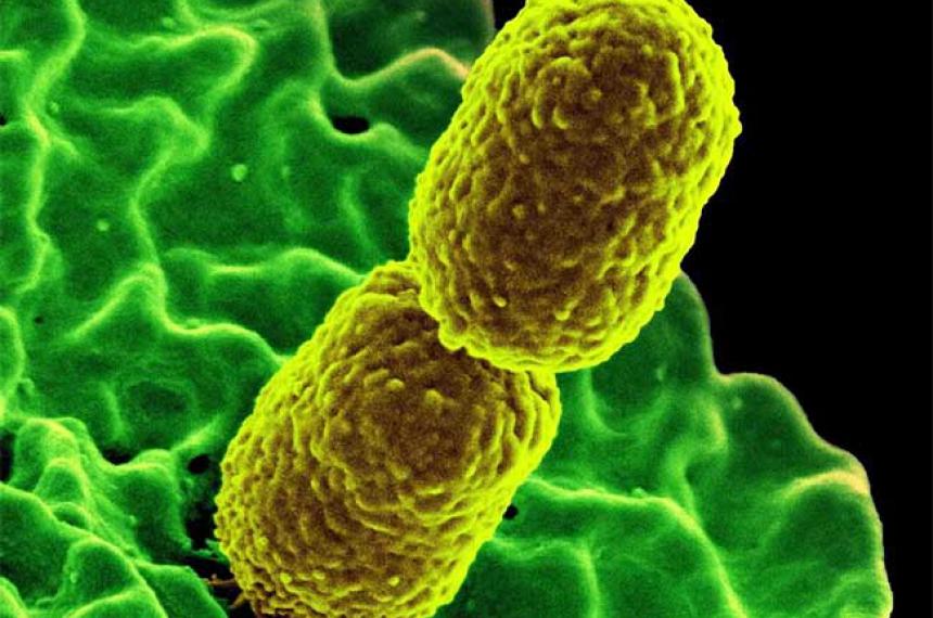Por primera vez se detectoacute una superbacteria resistente a 30 antibioacuteticos en Argentina