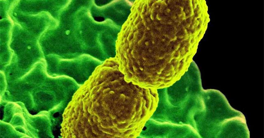 Por primera vez se detectoacute una superbacteria resistente a 30 antibioacuteticos en Argentina