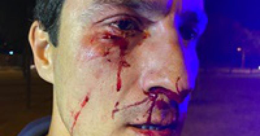 Asiacute quedoacute el rostro del policiacutea golpeado en Toay
