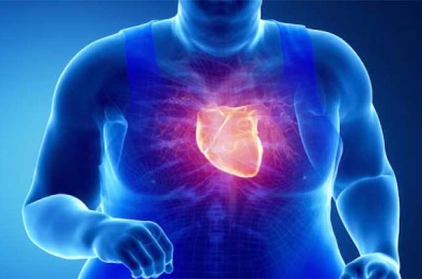 La obesidad dificulta el diagnoacutestico de las enfermedades cardiovasculares