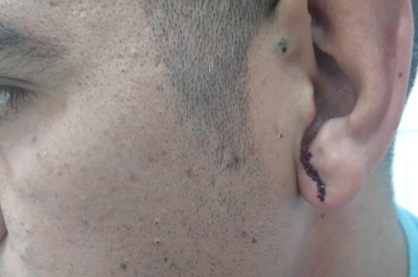 Denunciaron a policiacuteas de la Seccional Tercera por una golpiza a la salida de un boliche