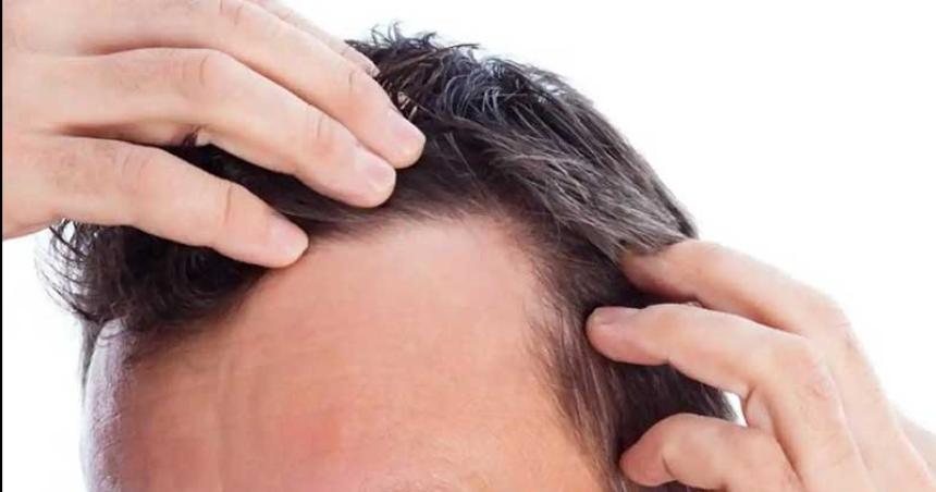 Estas son las 6 vitaminas fundamentales para evitar la caiacuteda del pelo