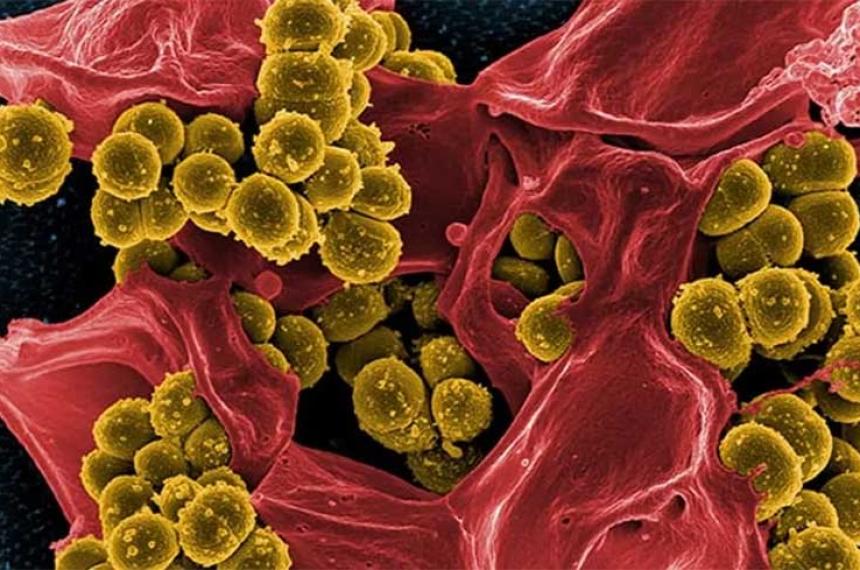 Un antibioacutetico antiguo podriacutea ser la clave contra las superbacterias