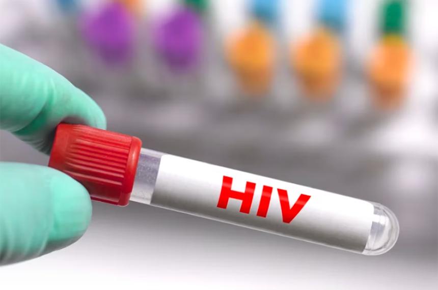 Avance contra el VIH- hallan una proteiacutena que ayuda al virus a permanecer latente