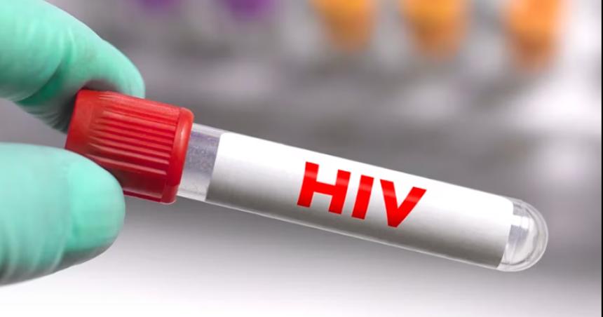 Avance contra el VIH- hallan una proteiacutena que ayuda al virus a permanecer latente