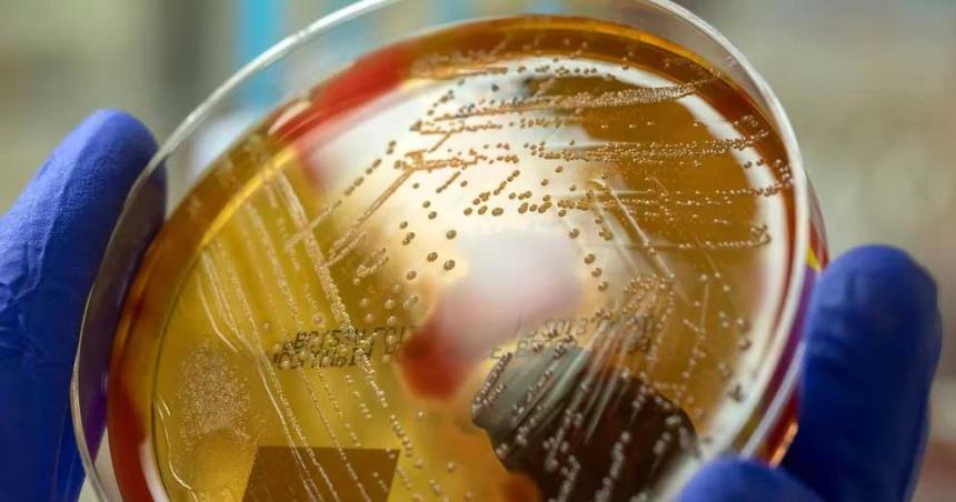 Faringitis- coacutemo ataca la suacuteper bacteria maacutes virulenta que provoca infecciones graves