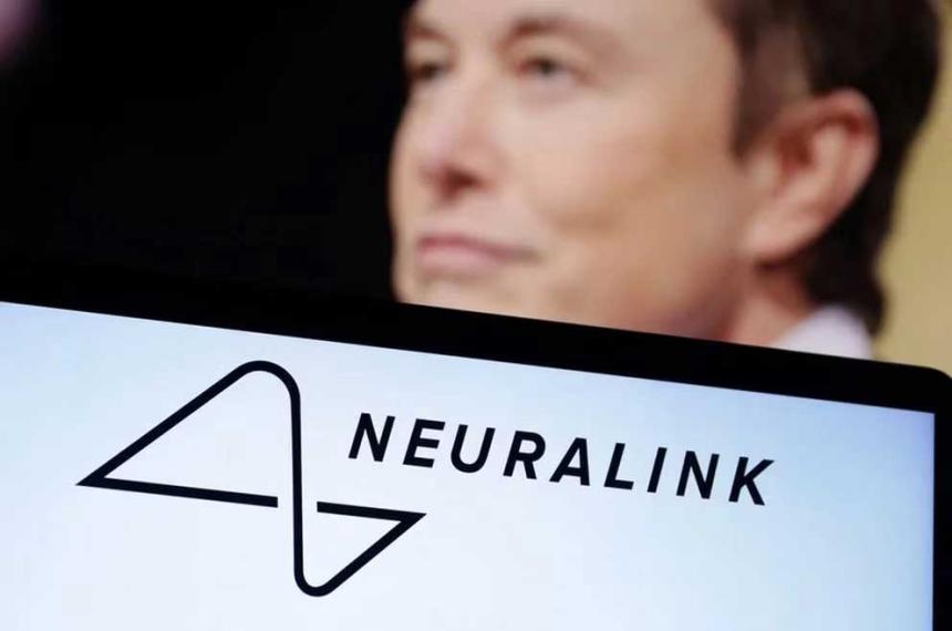 Neuralink obtuvo aprobacioacuten para ensayos cliacutenicos en humanos de su implante cerebral