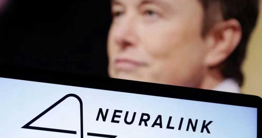 Neuralink obtuvo aprobacioacuten para ensayos cliacutenicos en humanos de su implante cerebral