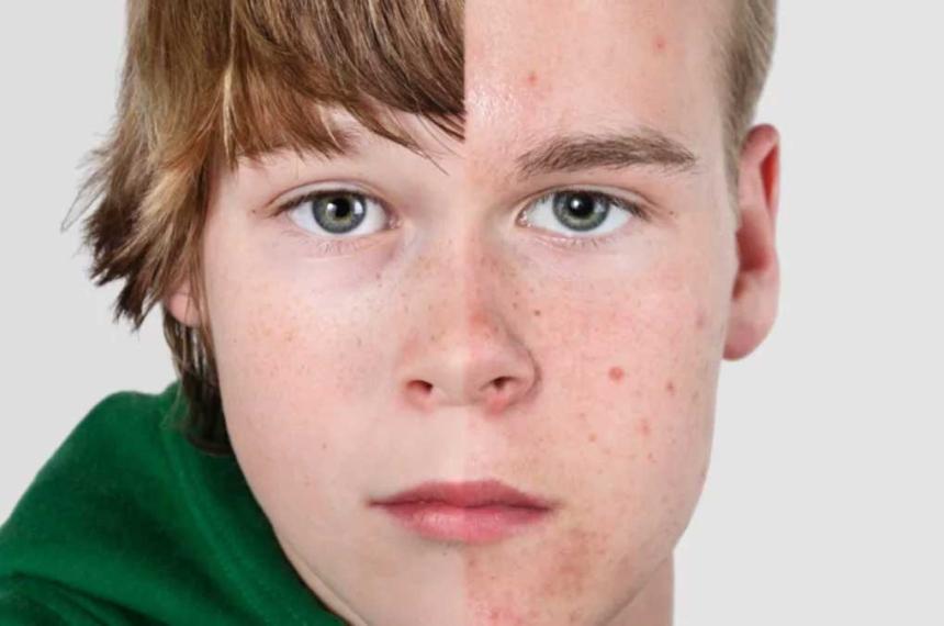 Pubertad iquestpor queacute se adelanta cada vez maacutes