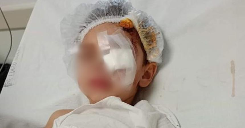 Un nintildeo herido en la cabeza por el ataque de un perro en Acha