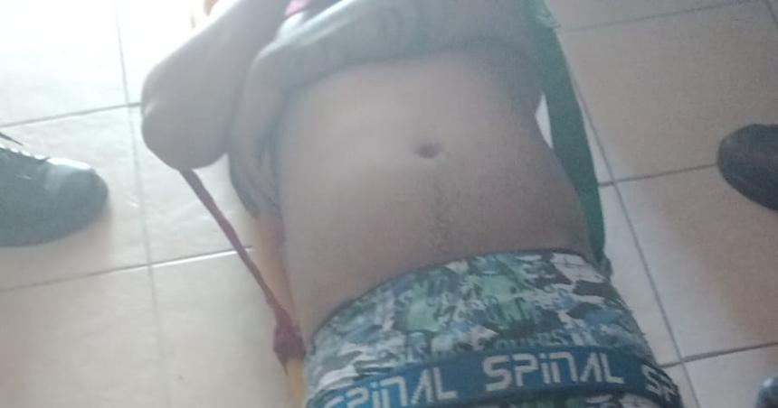 Se tiroacute de un primer piso y un policiacutea del Grupo Especial resultoacute baleado en el forcejeo