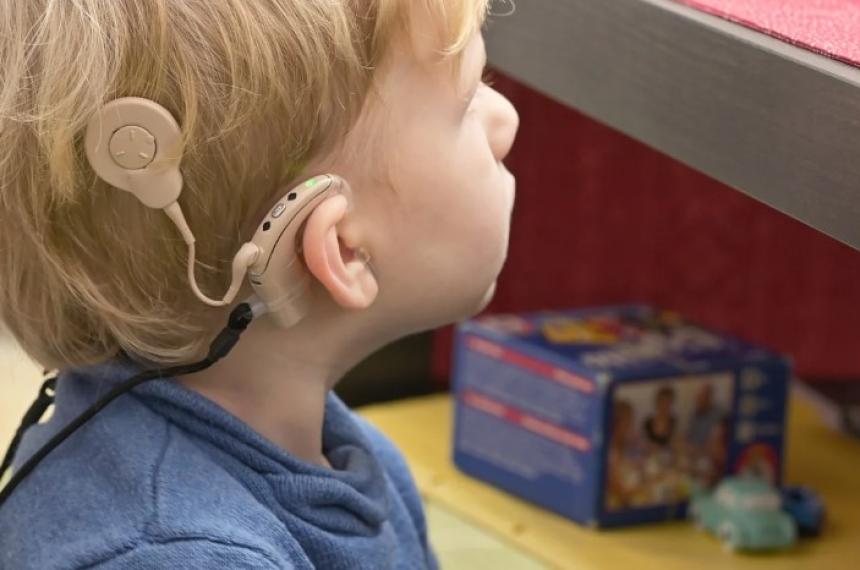 Diacutea Mundial del Implante Coclear- en Argentina maacutes de 500 mil personas viven con problemas auditivos