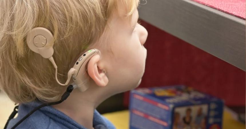 Diacutea Mundial del Implante Coclear- en Argentina maacutes de 500 mil personas viven con problemas auditivos
