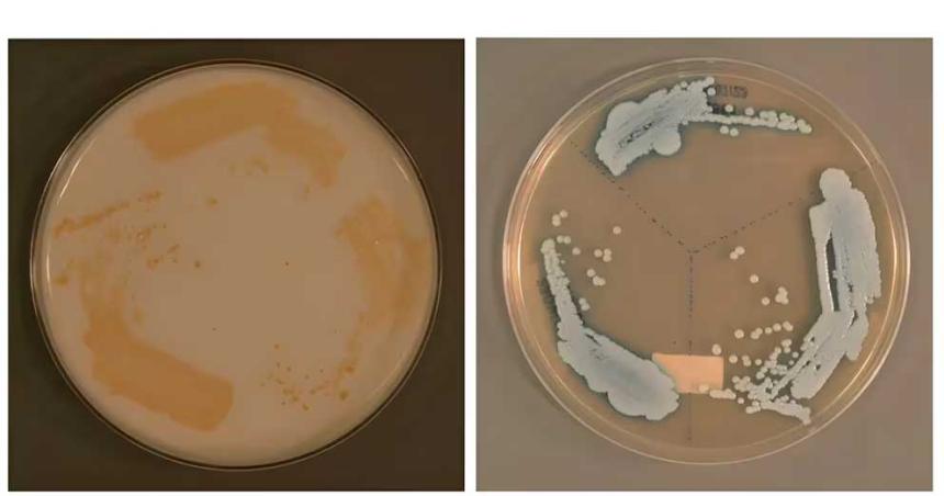 Por queacute un nuevo tipo de hongo Candida auris es una posible amenaza para la salud mundial