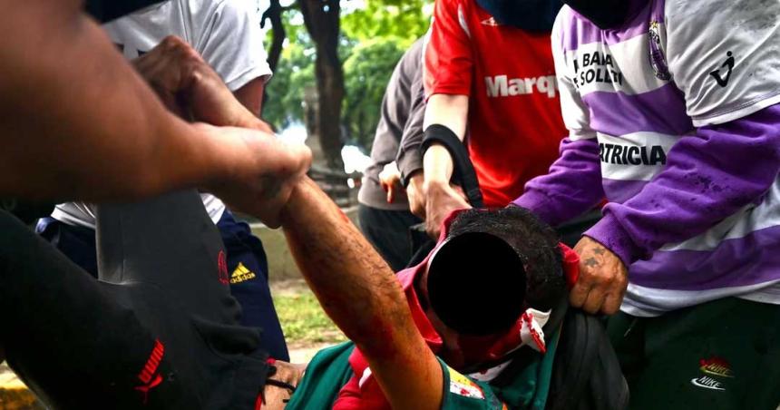 Bullrich sobre el fotoacutegrafo en estado criacutetico- Es consecuencia de los que generan violencia