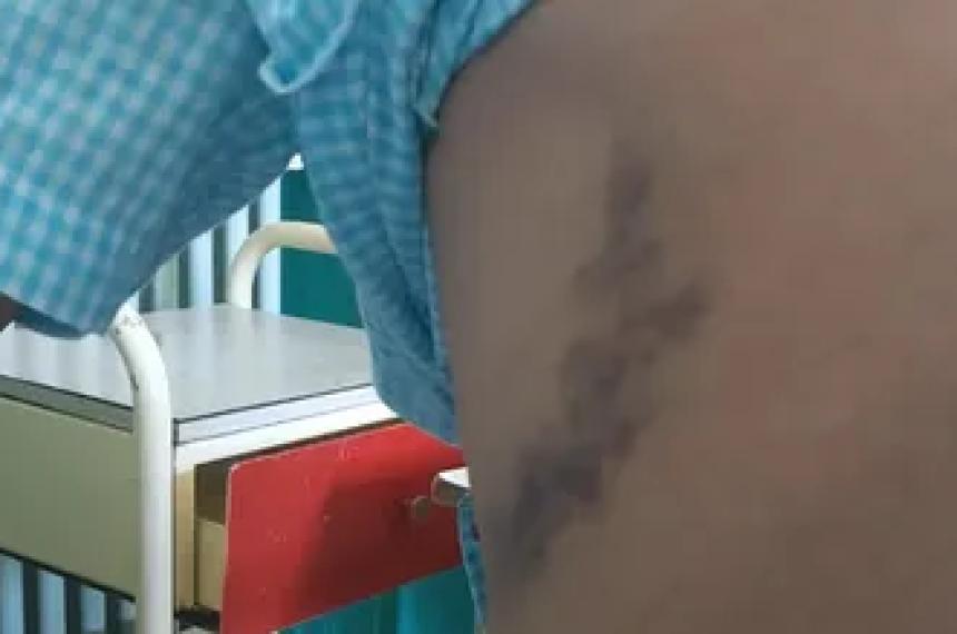 Victorica- Lo acusaron de robar un celular y lo atacaron en su propia casa