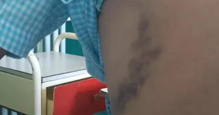 Victorica- Lo acusaron de robar un celular y lo atacaron en su propia casa