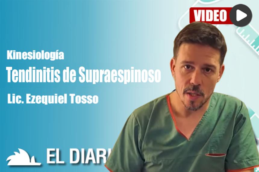 Tendinitis de Supraespinoso- Claves para Entender y Tratar el Dolor de Hombro