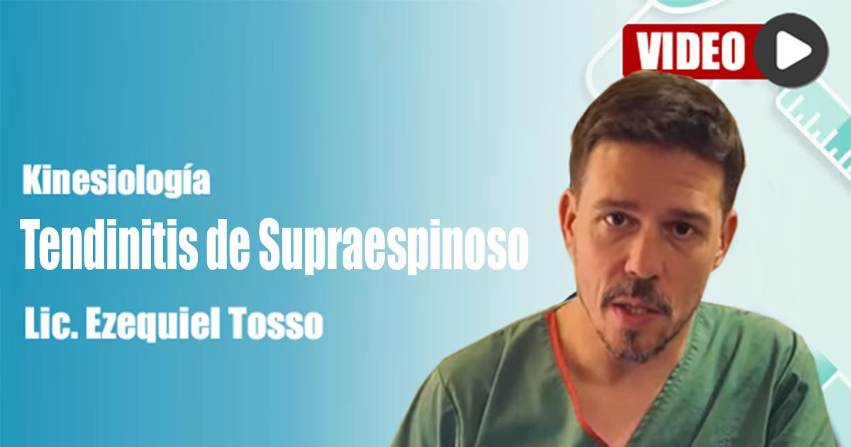 Tendinitis de Supraespinoso- Claves para Entender y Tratar el Dolor de Hombro