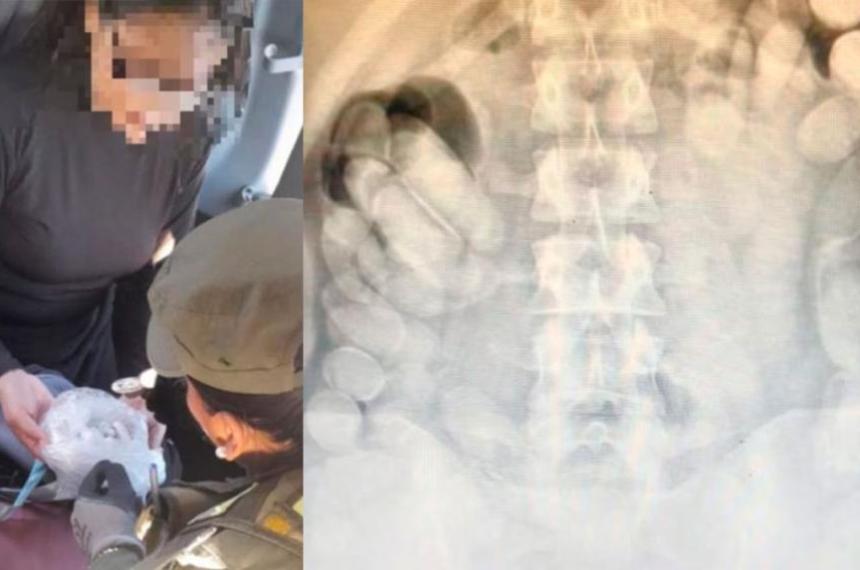 Detuvieron a una boliviana con maacutes de 100 caacutepsulas de cocaiacutena en su estoacutemago