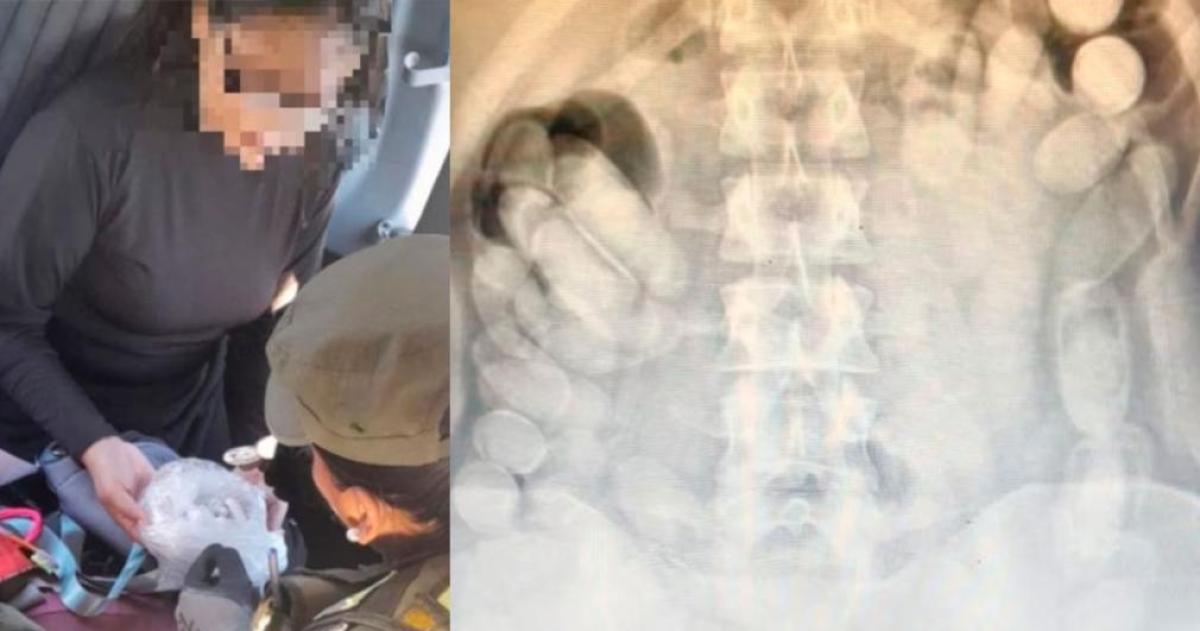 Detuvieron a una boliviana con maacutes de 100 caacutepsulas de cocaiacutena en su estoacutemago