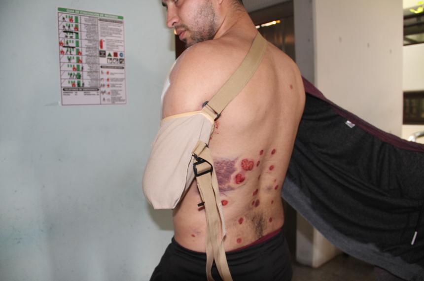 Baleado por la policiacutea en General Pico se presentoacute en la Fiscaliacutea