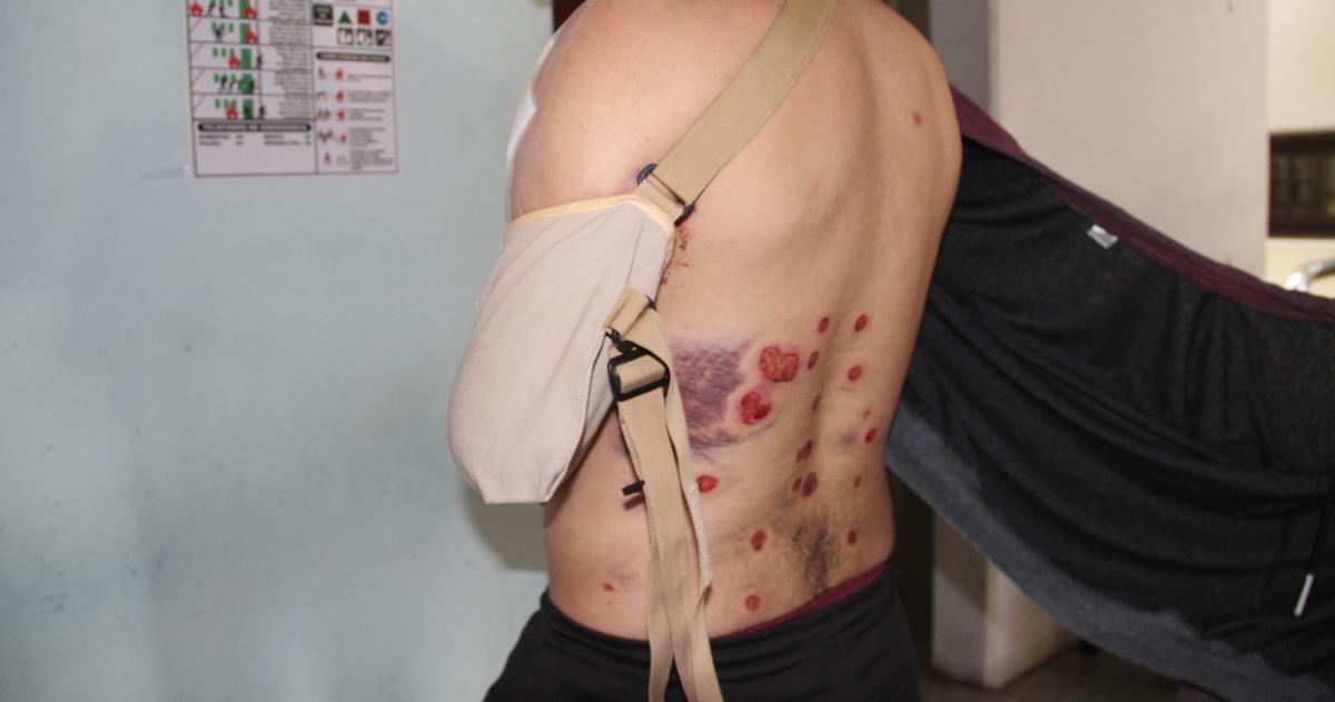 Baleado por la policiacutea en General Pico se presentoacute en la Fiscaliacutea