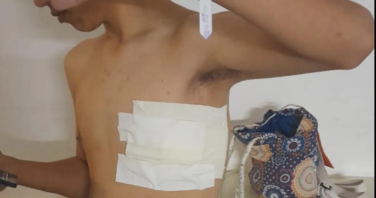 La Justicia ordenoacute botoacuten antipaacutenico para el alumno apuntildealado