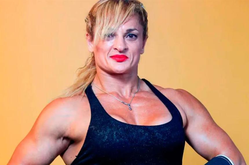 Alejandra Locomotora Oliveras se somete a una traqueotomiacutea tras sufrir un ACV isqueacutemico