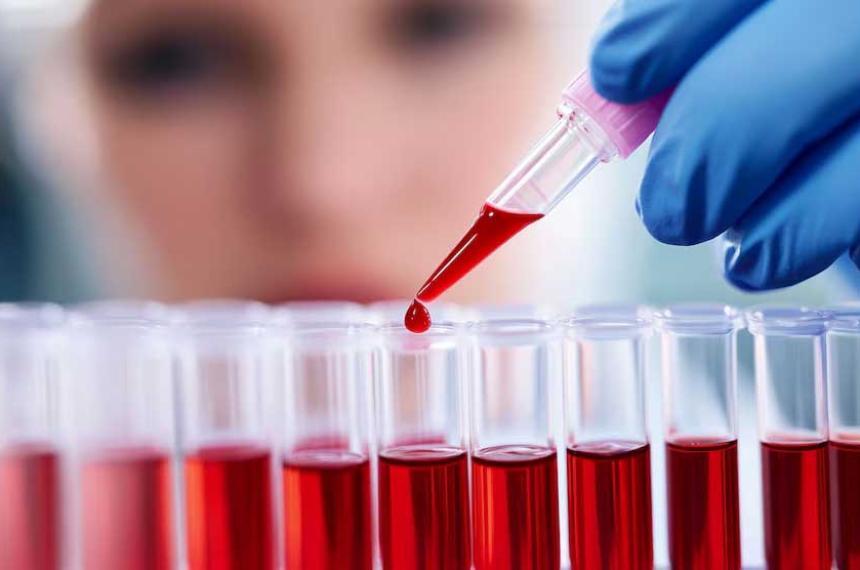 La prediabetes un peligro oculto para menores de 55 Antildeos