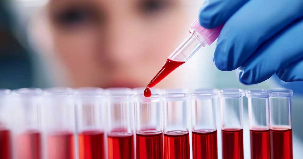 La prediabetes un peligro oculto para menores de 55 Antildeos