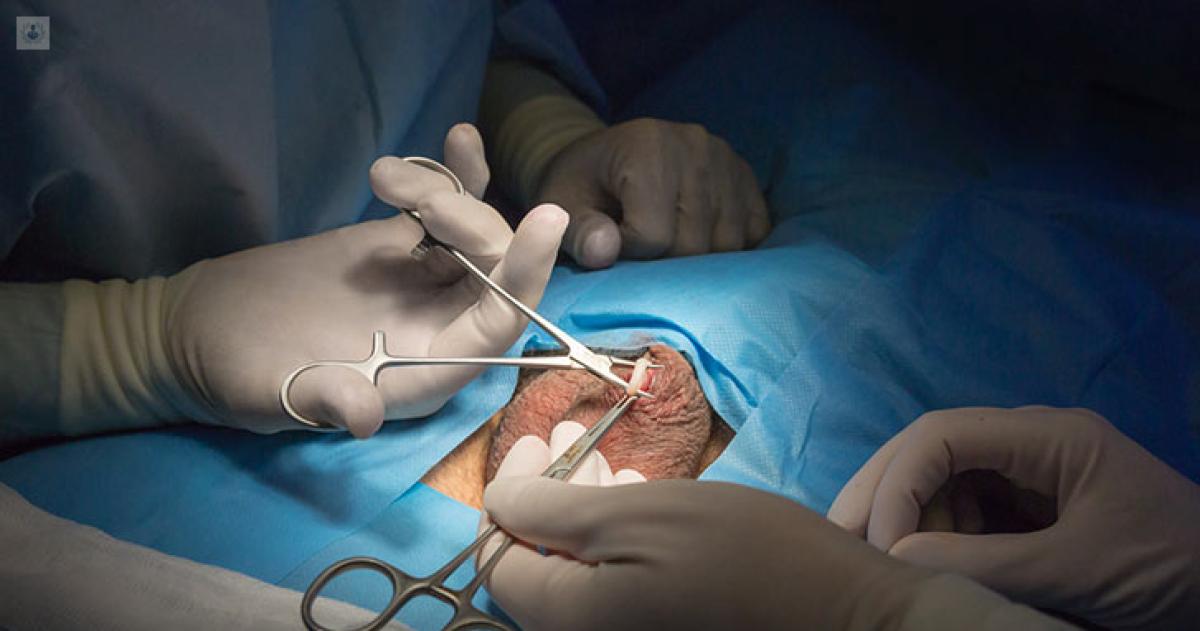Tras el auge maacutes hombres piden revertir la cirugiacutea para no tener hijos- los motivos detraacutes del cambio