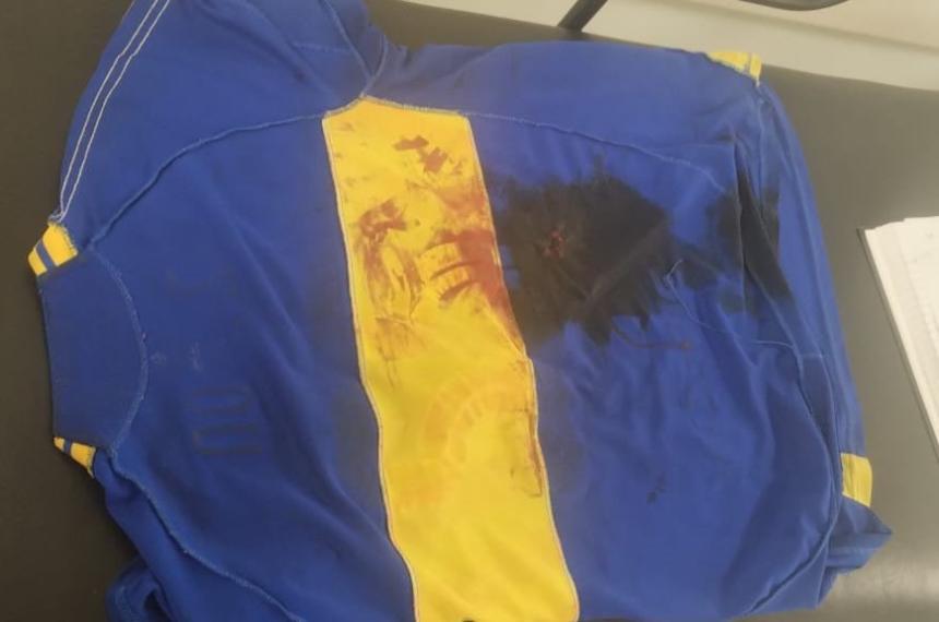 Gresca de madrugada- un joven fue apuntildealado con un fragmento de cuchillo en el barrio Matadero
