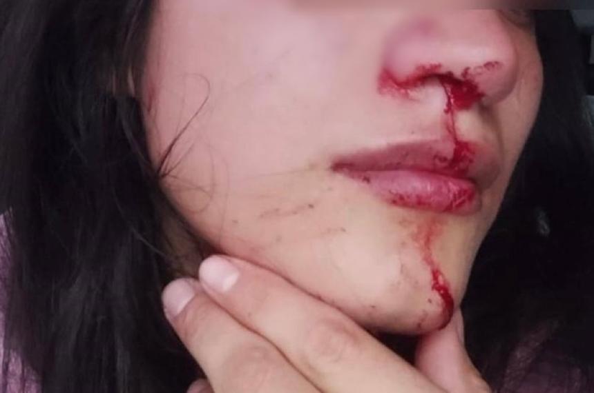 Denuncioacute a su ex por violencia de geacutenero y le dictaron una restriccioacuten de acercamiento