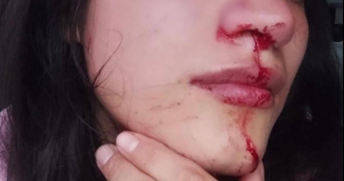 Denuncioacute a su ex por violencia de geacutenero y le dictaron una restriccioacuten de acercamiento