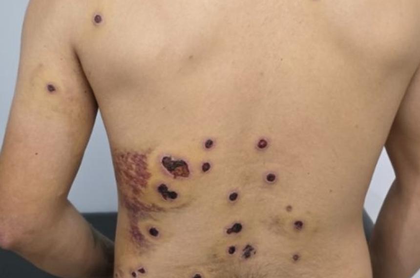 Formalizaron a un policiacutea por disparar contra un joven en Pico 