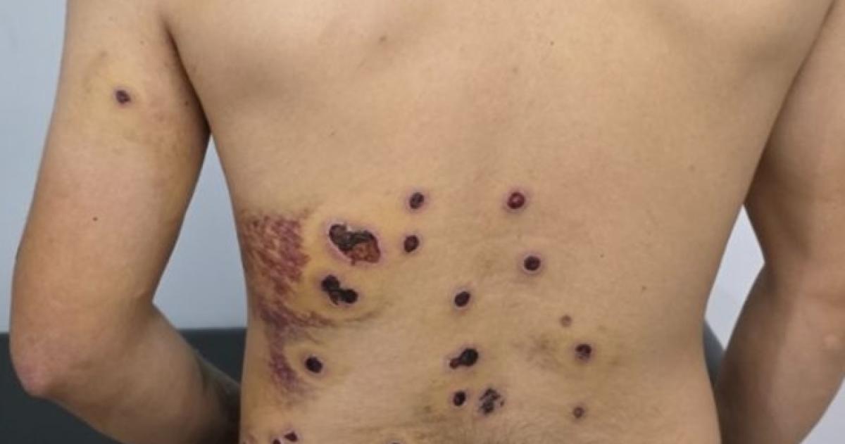 Formalizaron a un policiacutea por disparar contra un joven en Pico 