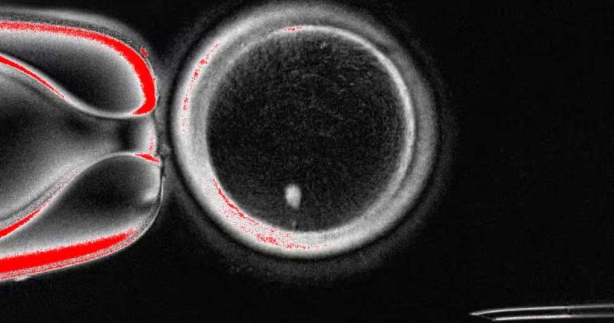 Crean oacutevulos funcionales a partir de ceacutelulas de la piel- un hito en reproduccioacuten asistida