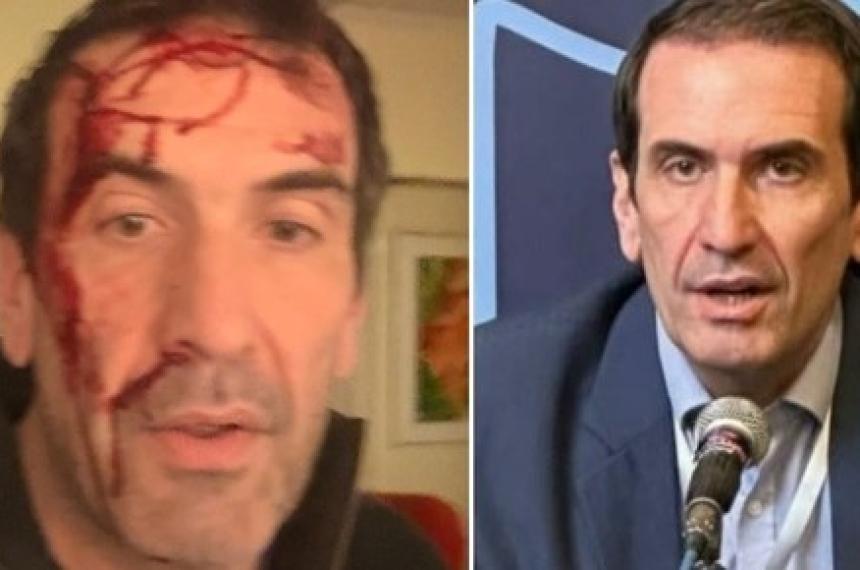 Pablo Cervia diputado nacional y candidato a senador nacional que denunció la golpiza