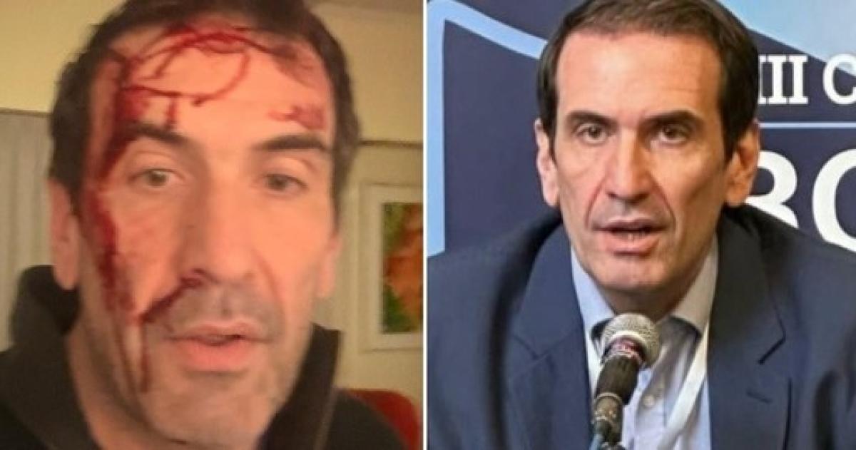 Pablo Cervia diputado nacional y candidato a senador nacional que denunció la golpiza