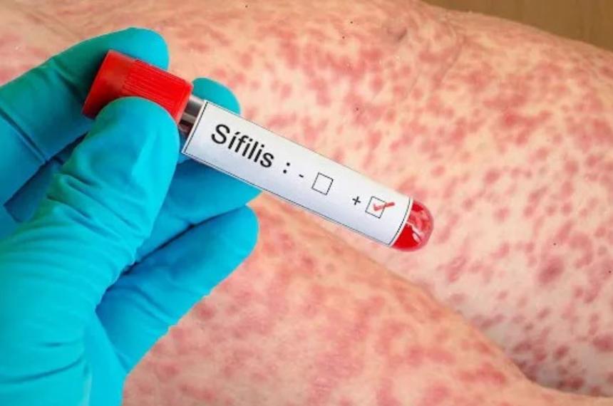 Preocupación sanitaria en un contexto nacional de crecimiento récord