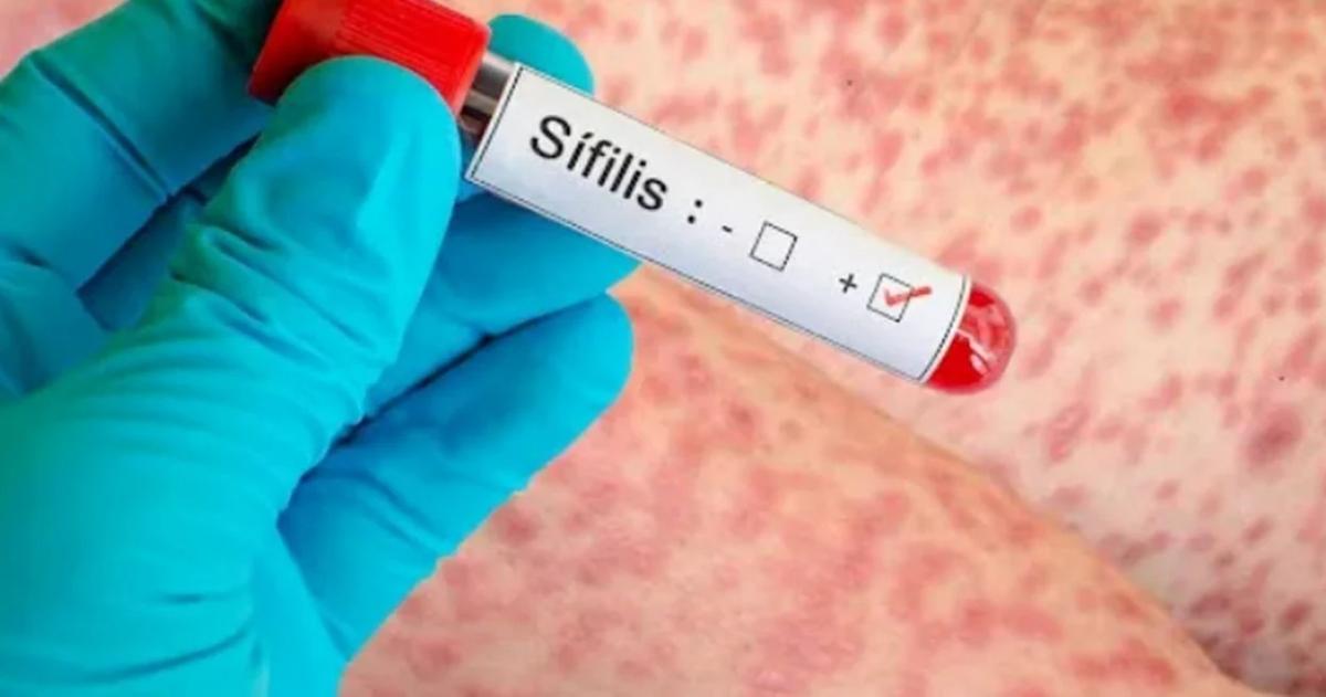 Preocupación sanitaria en un contexto nacional de crecimiento récord